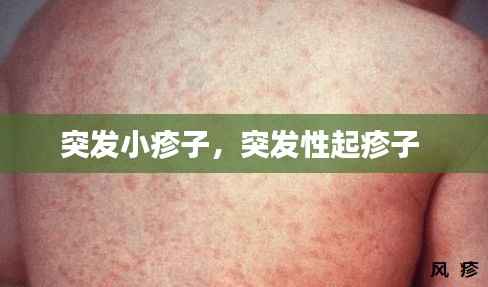 突发小疹子,突发性起疹子